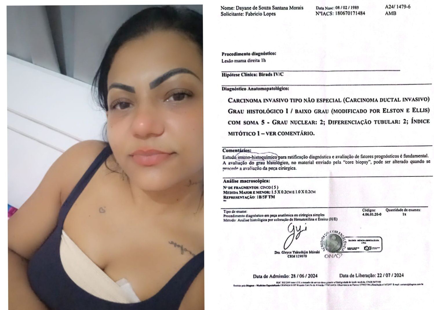 Com prazo para entregar casa onde mora, cubatense luta contra o Câncer de Mama e enfrenta desafios com os filhos autistas.